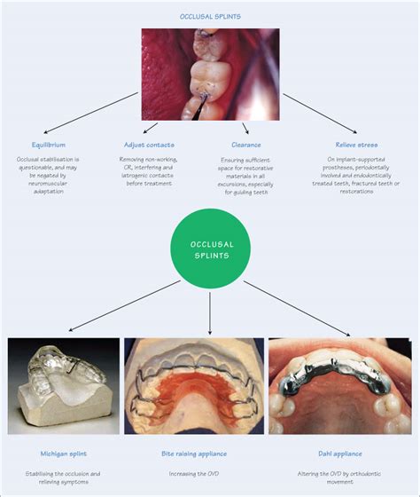 The Relationship Between Occlusal Anatomy and Dental Occlusion